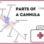 Parts of a Cannula with Diagram
